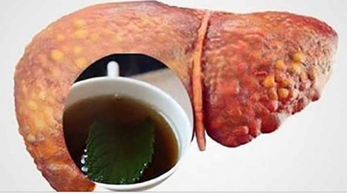 Неймовірний напій для вас, який очищає вашу печінку і спалює весь черевний жир…