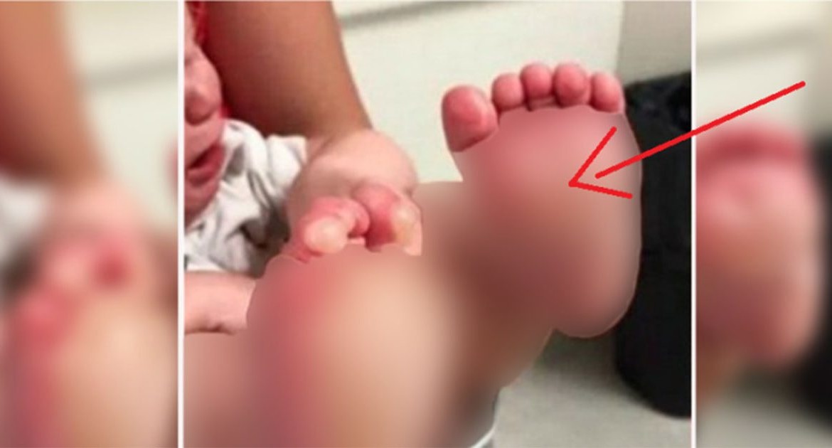 Мати залишила малюка з нянею. Повернувшись додому, вона була вж@ху коли побачила його ніжки!