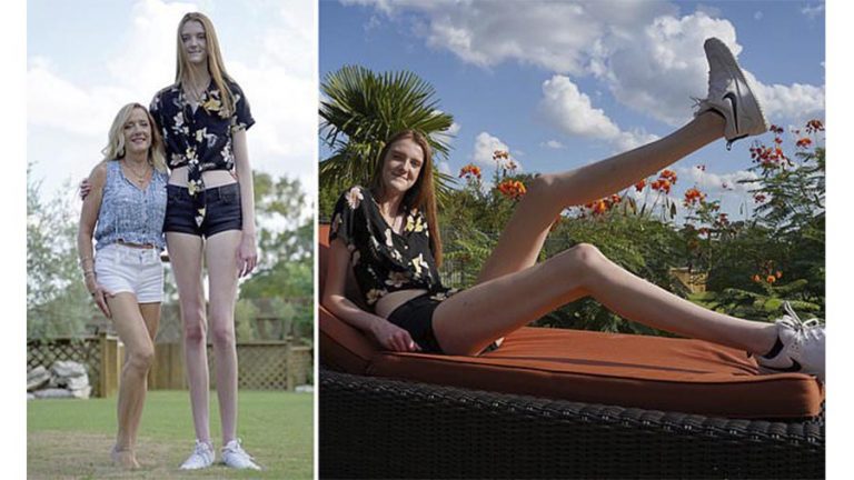 17-річна дівчина є володаркою найдовших ніг у світі…