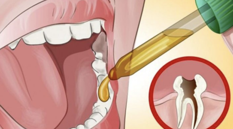 Біль зникає за 1 секунду! Як швидко позбутися від тяжкого зубного болю коли у вас немає можливості потрапити до стоматолога?