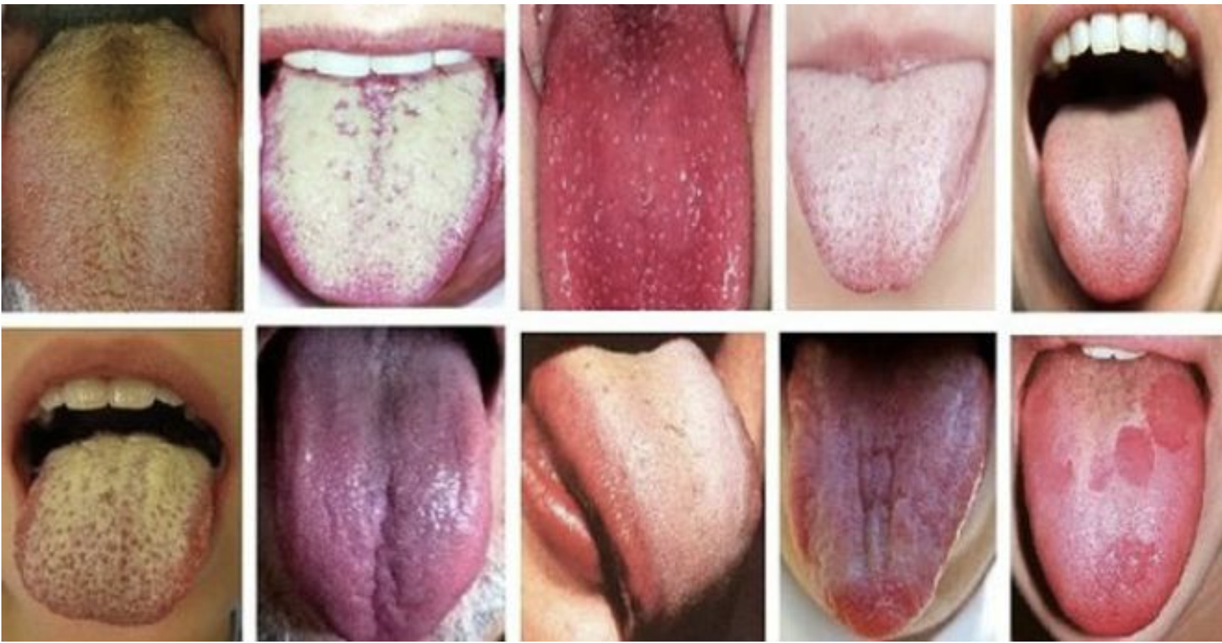 Перевірте обов’язково колір вашого язика, він розповість вам дуже цікаве про стан здоров’я…