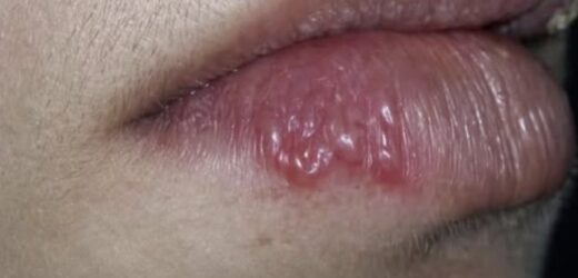 Лікар попередив людей! Зараз по всій Україні! Зробіть це щоб не підцепити заразу