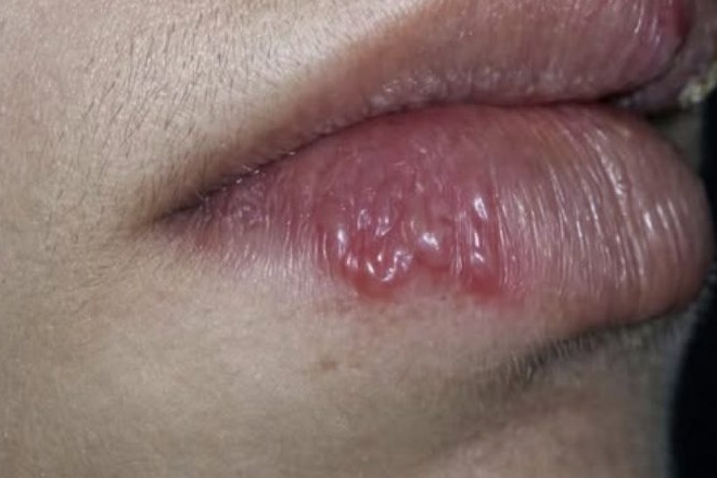 Лікар попередив людей! Зараз по всій Україні! Зробіть це щоб не підцепити заразу